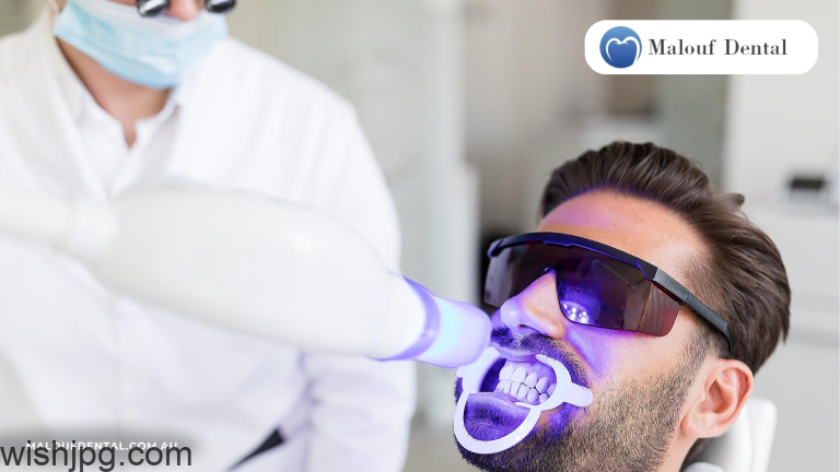 Should You Whiten Your Teeth at Home or at the Dentist? 12 1